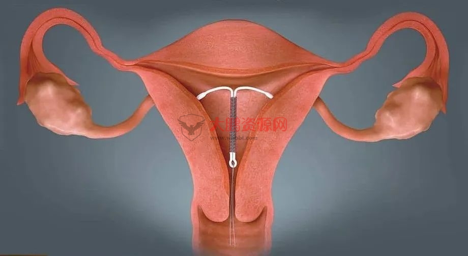 图片[4]-避孕不止安全套，17种避孕方法了解一下好兄弟们-希音出海